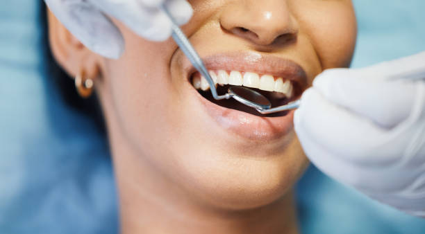 Best Emergency Tooth Extraction in North Utica, IL