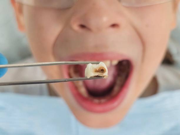 Best Emergency Orthodontic Repairs in North Utica, IL